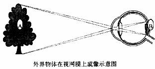 观察物体在视网膜上的成像示意图回答