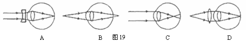 摘要6图4所示的四幅图中能正确表示近视眼成像情况的图是能正确表示