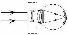 矫正方法,在图中虚线框内划出矫正所需要的透镜并完成矫正后的光路图