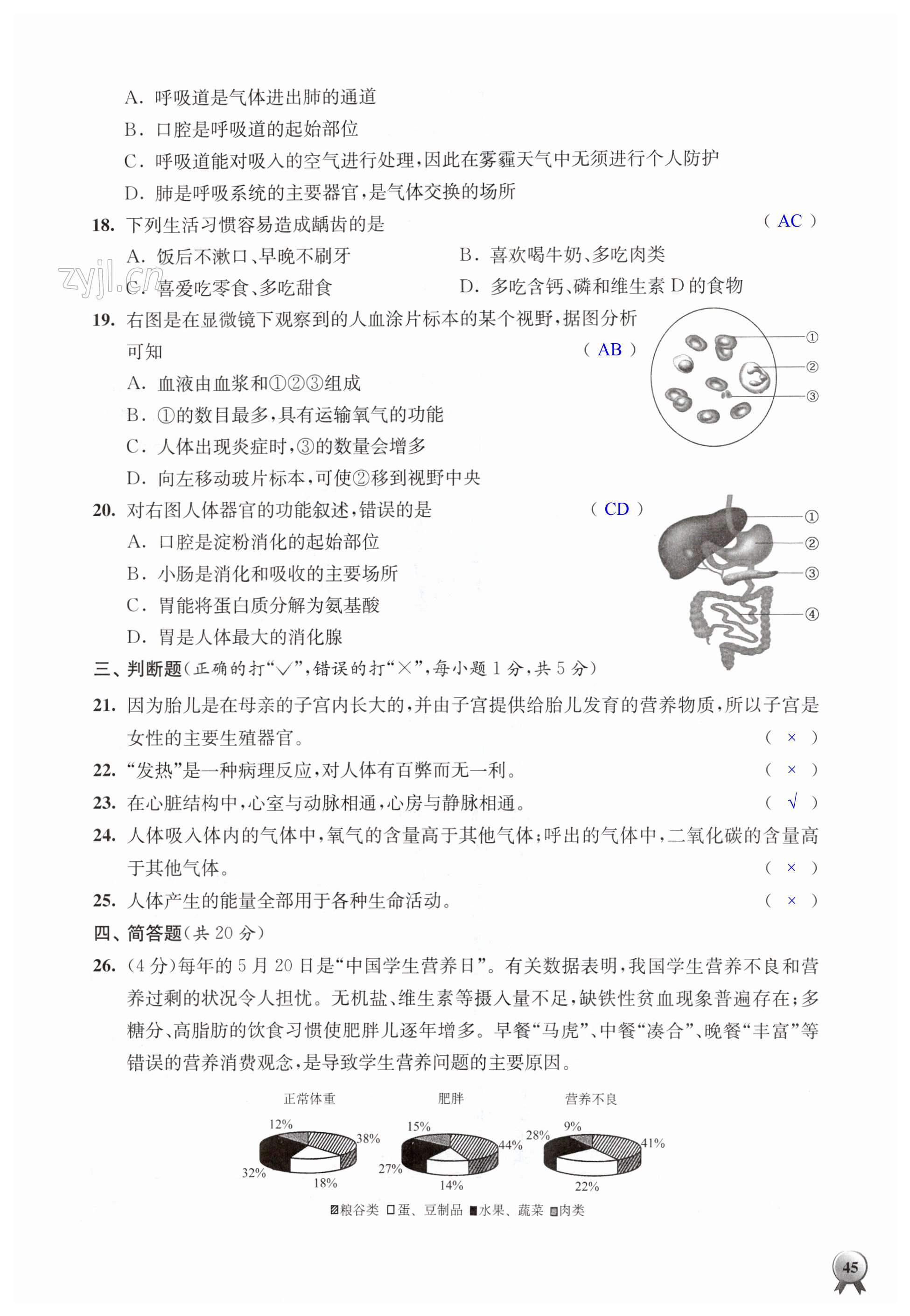 第45页