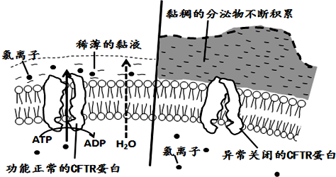 囊性纤维化(cf)是一种常染色体隐性遗传病.主要影响胃肠道和呼吸系统.