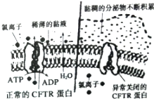 囊性纤维病是编码一个跨膜蛋白cftr的基因缺失了3个碱基导致cftr蛋白