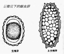 临床多数无明显自觉症状;蛔虫病人粪内含有受精卵,是人群中蛔虫感染的