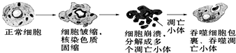 该过程只发生在胚胎发育过程中 c,吞噬细胞吞噬凋亡小体与溶酶体有关