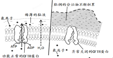 囊性纤维病产生的根本原因是( )