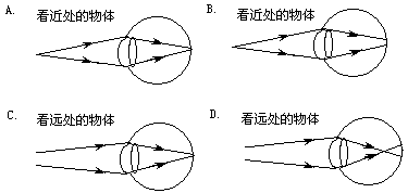 描述正常眼的成像情况的是 ,描述近视眼的成像情况是 ,描述了远视眼