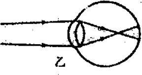 2,在下图中,_____图(选填"甲"或"乙")表示近视眼成像示意图.