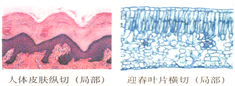 對比人體皮膚縱切片和迎春葉橫切片的光學顯微鏡圖象下列說法不正確的