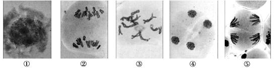 蝗虫精母细胞减数图图片