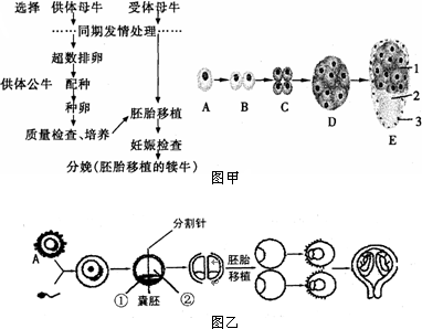 孕囊结构图解析图片